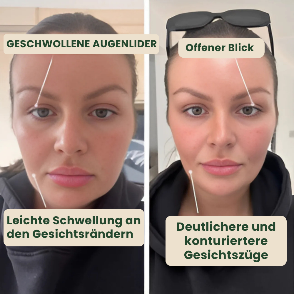 Avelia Natürliche Lymph Tropfen